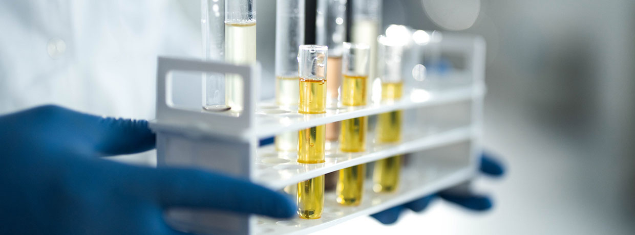 Cannabielsoxa: Forscher entdecken neues Cannabinoid aus Hanf